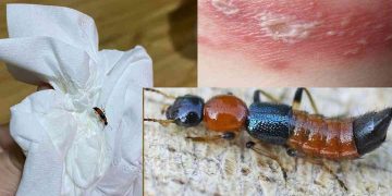 Kiến ba khoang là gì?