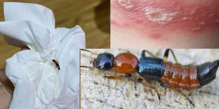 Kiến ba khoang là gì?