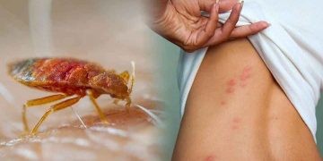 Rệp giường có nguy hiểm hay không?