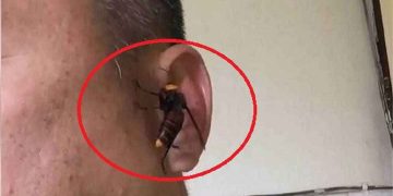 Ong bắp cày đốt có nguy hiểm không?