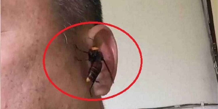 Ong bắp cày đốt có nguy hiểm không?