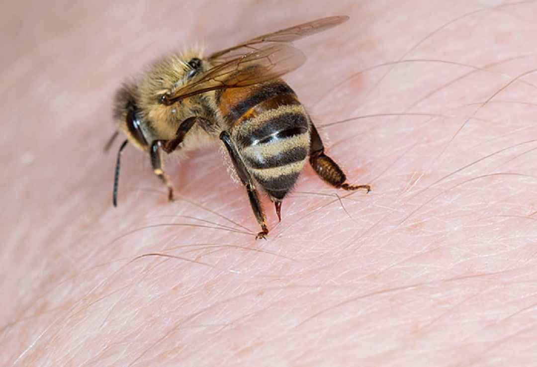 Ong chích vs Wasp Sting